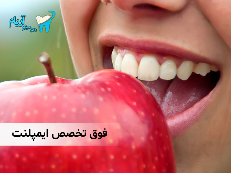 بهترین متخصص ایمپلنت تهران را بشناسید