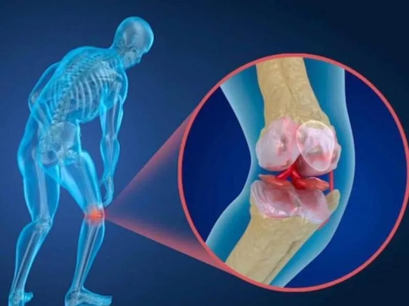 صندوق بیماران صعب العلاج بیمه سلامت شامل ٢٢ بیماری خاص است  