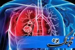 روند افزایشی شیوع بیماری سل در مهریز